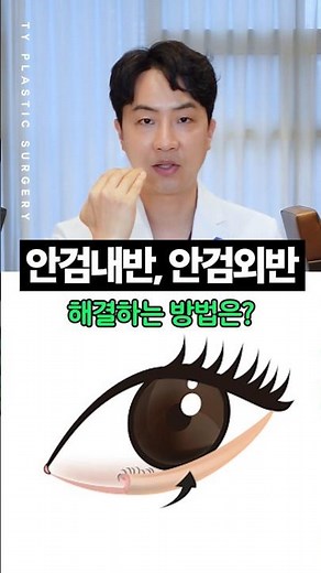 안검내반, 안검외반 해결 방법 #인천성형외과