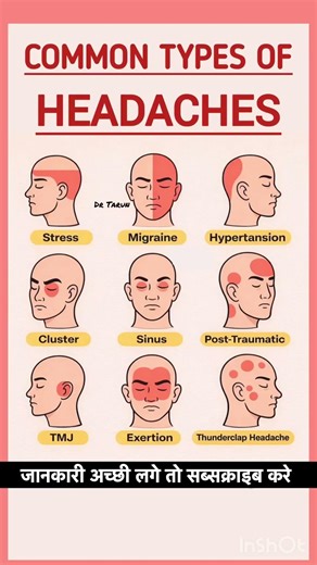 Common Types of Headaches Explained | Migraine, Stress, Sinus & More | Causes & Symptoms Guide