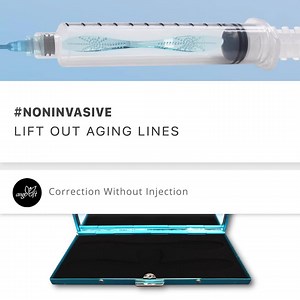 319K views · 196 reactions | New cosmetic lift provides long term results and overall improvement over injections! | AngelLift | Facebook