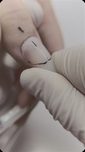 A new online course on upper forms is launching soon! While we are...