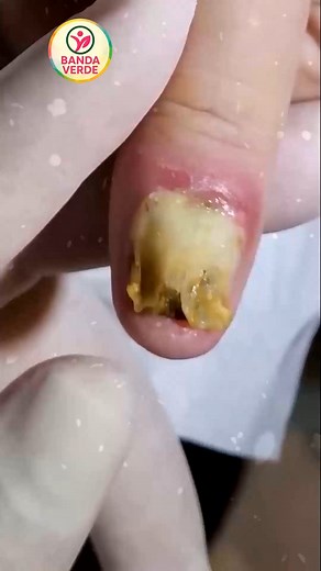 Heart-friendly fats and budget habits ease rainy mornings #HeartFriendly #BudgetWellness #CalmConfidence | Banda Verde