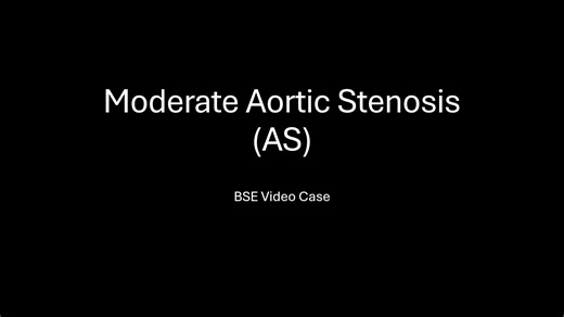 BSE Video Case – Aortic Stenosis
