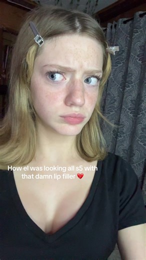 Millie Bobby Brown's Lip Filler Debate in Stranger Things 5