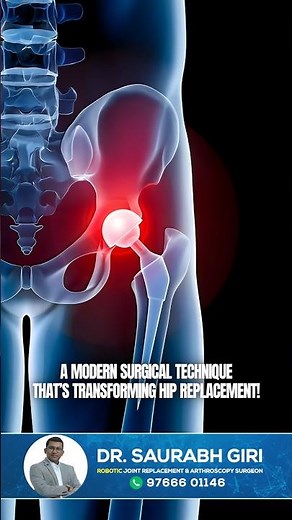 Transform Your Hip Health with Direct Anterior Approach (DAA) | Dr. Saurabh Giri