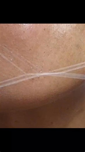 Pure frustration #hairy #threading #pcos #satisfying #threadinghairremoval #beautycare | threading hairs