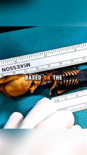 2.9K views · 22 reactions | Atacama Skeleton | Tito Clips | Facebook