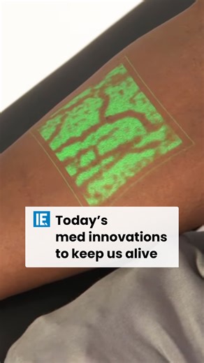 16K views · 70 reactions | Discover game-changing medical inventions that have revolutionized healthcare! #engineering | Interesting Engineering | Facebook