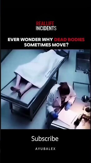 Why Dead Bodies Move After Death? (Rigor Mortis Explained) 😨 | #Sciencefacts #shorts