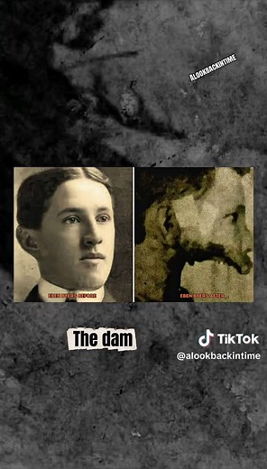 The sad story of Eben Byers who was a victim of radium water in the 1900s #forgottenhistory #historytime #historybuff #darkhistory #fypシ゚viral