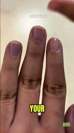 Why Do Fingernails Turn Blue? 😱