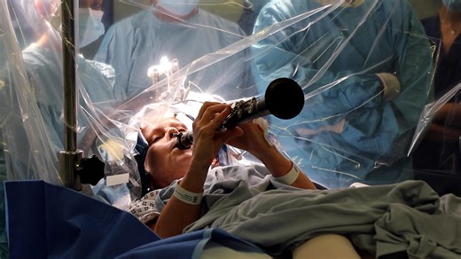 A woman with Parkinson’s disease played the clarinet while undergoing deep brain stimulation, helping doctors to instantly hear the results of the procedure. | USA TODAY Video | Facebook