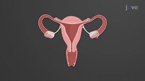 Video: Infertility in Females