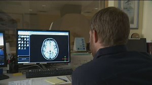 Neuropathologist: Mystery brain disease deaths in New Brunswick were misdiagnosed