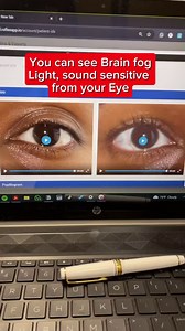 10K views · 145 reactions | Comment ”Pupil“ ️ if you want to know...