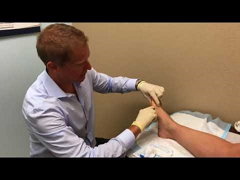 Big toe injection for foot pain