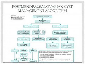 Post menopausal ovarian cyst