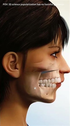 Jaw Bone Correction surgery (Osteotomy) #osteotomysurgery #osteotomy #jawcorrection #maxilla