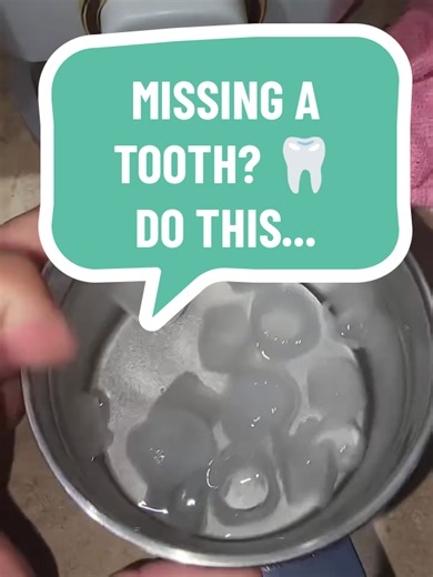 DIY Temporary Tooth Replacement with Thermal Beads