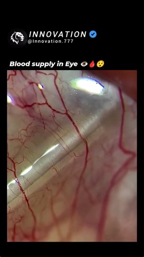 Innovation™ on Instagram: "This video offers a fascinating microscopic look at the human eye, which is one of the most accessible places in the body to directly observe the passage of red blood corpuscles in a living person. The close-up footage reveals a complex network of tiny, winding blood vessels on the surface of the eye. ​Through the translucent tissue, you can actually see individual red blood cells as they are pumped through the capillaries, moving in a rhythmic, pulse-like fashion. The