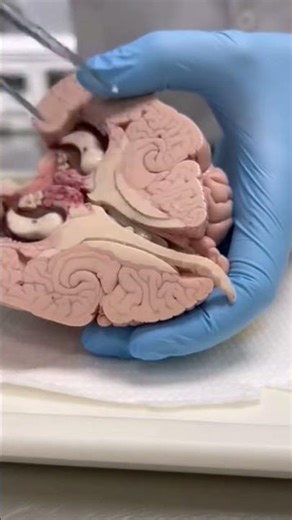 Dissecting the Nervous System: A Journey Inside the Body’s Control Center. #neuroanatomy#medical