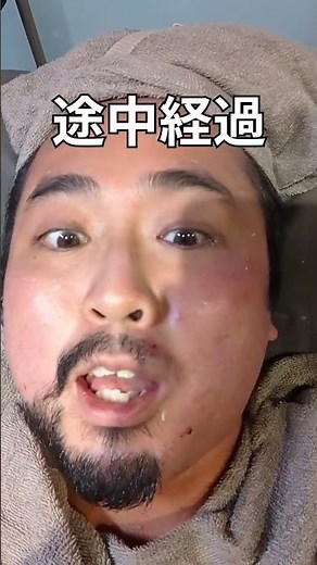 1ヶ月間生やした髭をブラジリアンワックスで抜いてみた。#脱毛 #ブラジリアンワックス #髭脱毛 #脱毛サロン #メンズ脱毛 (EvaWax銀座店)