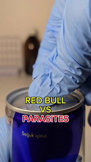 Under The Microscope: Exploring Parasites