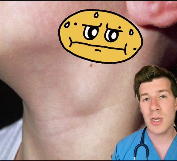 Lymph Node Swelling: Key Symptoms in Diagnosis