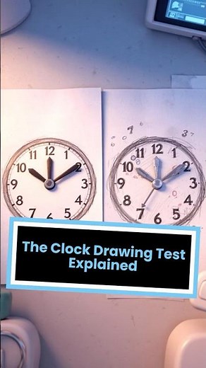 The Clock Drawing Test - A Simple Tool to Screen for Dementia #dementia #dementiacare #alzheimers