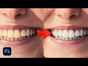 How to Whiten The Teeth Using 2 minutes in Photoshop 2025 | Photoshop Tutorial