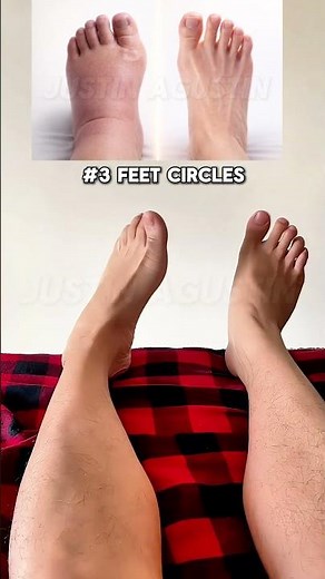 Gentle Exercises for Swollen Feet
