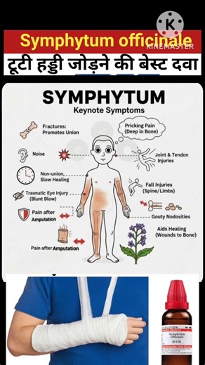 Symphytum for bone pain and fracture #song #trending #alternativemedicine #health #fracture #pain