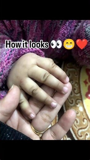 Tiny Baby Nails 👶💅 | How They Look & How They Feel | Baby Care#babynails#babycare#tinyfingers#shorts