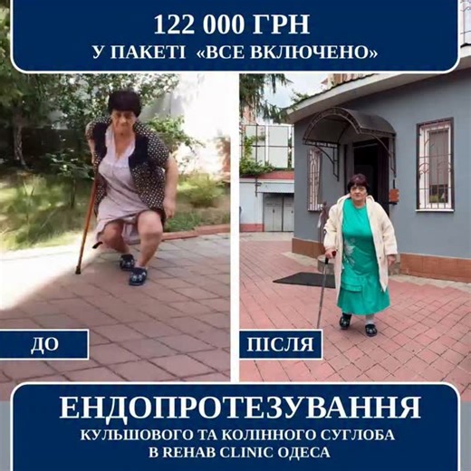 ⚓♥️ ОДЕССА | ПОСЁЛОК КОТОВСКОГО | ПОСКОТ on Instagram: "РІШЕННЯ, ЯКЕ НЕ МОЖНА ВІДКЛАДАТИ 🏥 Rehab Clinic | Одеса 💎 Заміна кульшового та колінного суглоба Без прихованих платежів. Без ризику. Без черг. 💰 ПАКЕТИ «ВСЕ ВКЛЮЧЕНО»: ✅ Covision (🇬🇧 Велика Британія) 🦴 Кульшовий суглоб — 98 000 грн ✅ MicroPort (🇺🇸 США) 🦴 Кульшовий або колінний суглоб — 122 000 грн 📦 У ВАРТІСТЬ ВХОДИТЬ УСЕ: ✔️ Повна діагностика та аналізи ✔️ Консультації хірурга та анестезіолога ✔️ Операція + преміальний імплант ✔