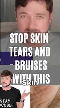 Heal Skin Tears And Bruises With This Simple Trick