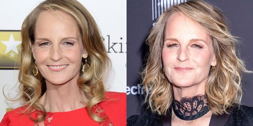 Did Helen Hunt Have Plastic Surgery? Alleged 'Before & After' Photos