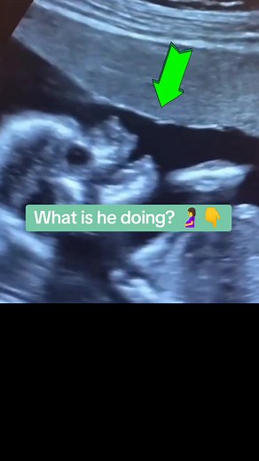 234dultrasoundlad on TikTok