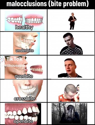 Understanding Different Types of Bites and Bite Problems