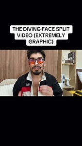 20K views · 536 reactions | THE DIVING FACE SPLIT VIDEO (EXTREMELY GRAPHIC) | Elninobrah | Facebook