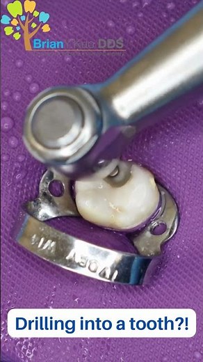 Drilling a hole in the tooth! #shorts #satisfying