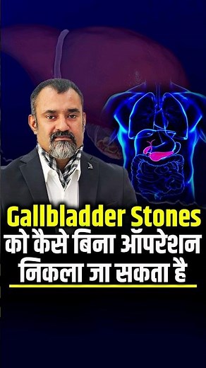 How to Remove Gallbladder Stones Without Surgery | Prashant Kapoor
