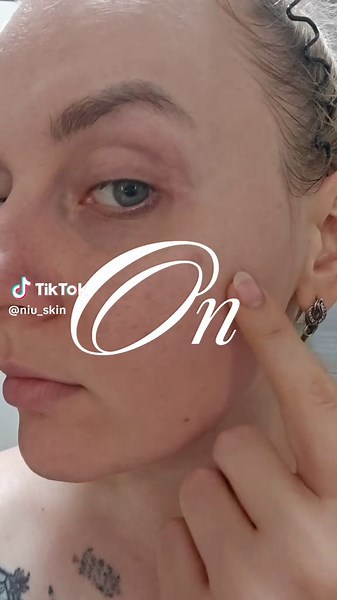 When Redness Strikes, Niu Skin Comes to the Rescue! 🌿 Flushed skin? Visible redness? Sensitivity taking over your glow? Don't let irritation steal your confidence — Niu Skin is here to calm, soothe, and restore. ✨ Niu Skin Calming Collection is specially formulated to: ✅ Reduce redness & soothe irritation ✅ Strengthen your skin barrier ✅ Restore comfort & balance ✅ Bring back your natural radiance Whether it's environmental stress, sensitivity, or reactive skin — trust Niu Skin to come to the r