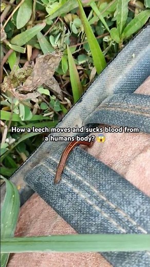How leeches move and sucks blood out of human body? 😱 #leech #parasite #parasitic #insects #leeches