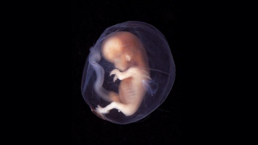 Wat is een embryo? Het verschil tussen embryo & foetus