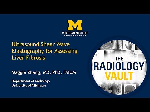 Ultrasound Elastography for Liver Fibrosis