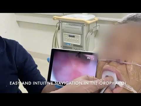 Awake Tracheal Intubation in a Patient with Difficult Airway with ProVu videostylet