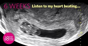 Amazing: At just 21 days from fertilization, a preborn child has a beating heart! Turn your SOUND ON to hear the heartbeat of a baby at six weeks. #LoveBothVoteNO Video credit: LoveBoth Project | Live Action