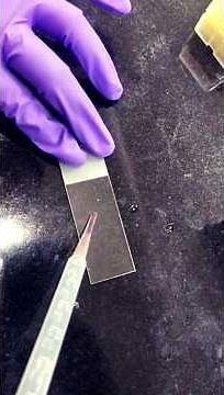 Bacteria in spoiled chicken under microscope