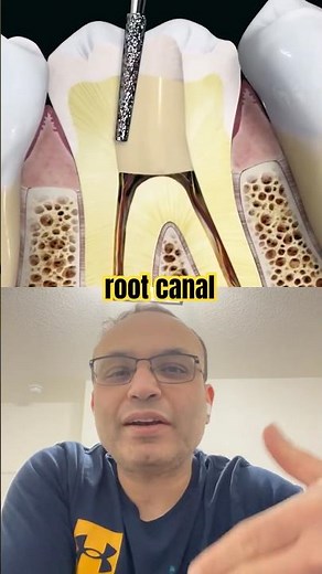What Really Happens in a Root Canal 👀