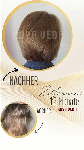 Haarausfall? Diese Ergebnisse sprechen für sich! | Natürlich gesundes Haar mit der KAYA VEDA-Methode
