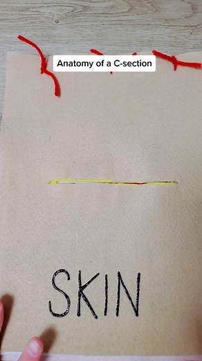 Here is a VERY general description of how a C-section is performed. I use this as an education tool when doing birth prep or rehab after birth. #csectionawareness #pregnancytiktok #csectionrecovery